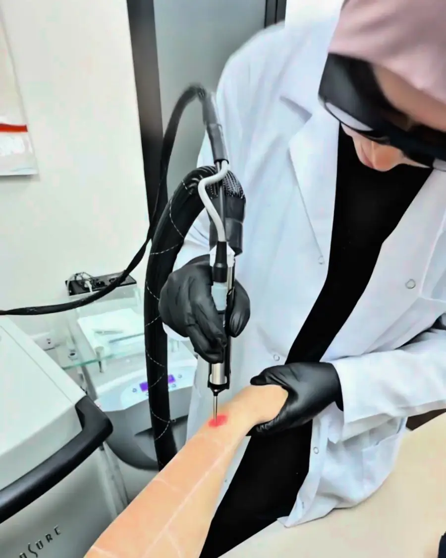 Une séance d'épilation laser réelle — Dr. Meryem au travail, Refine Clinic, Tanger